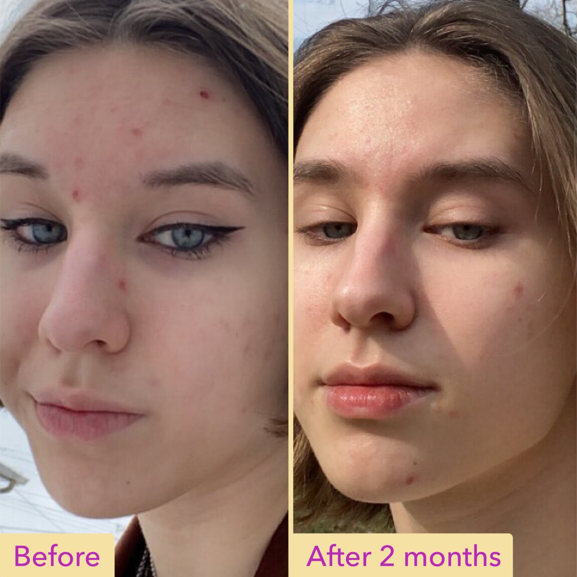 niacinamide-serum-y1 zb_p.jpg