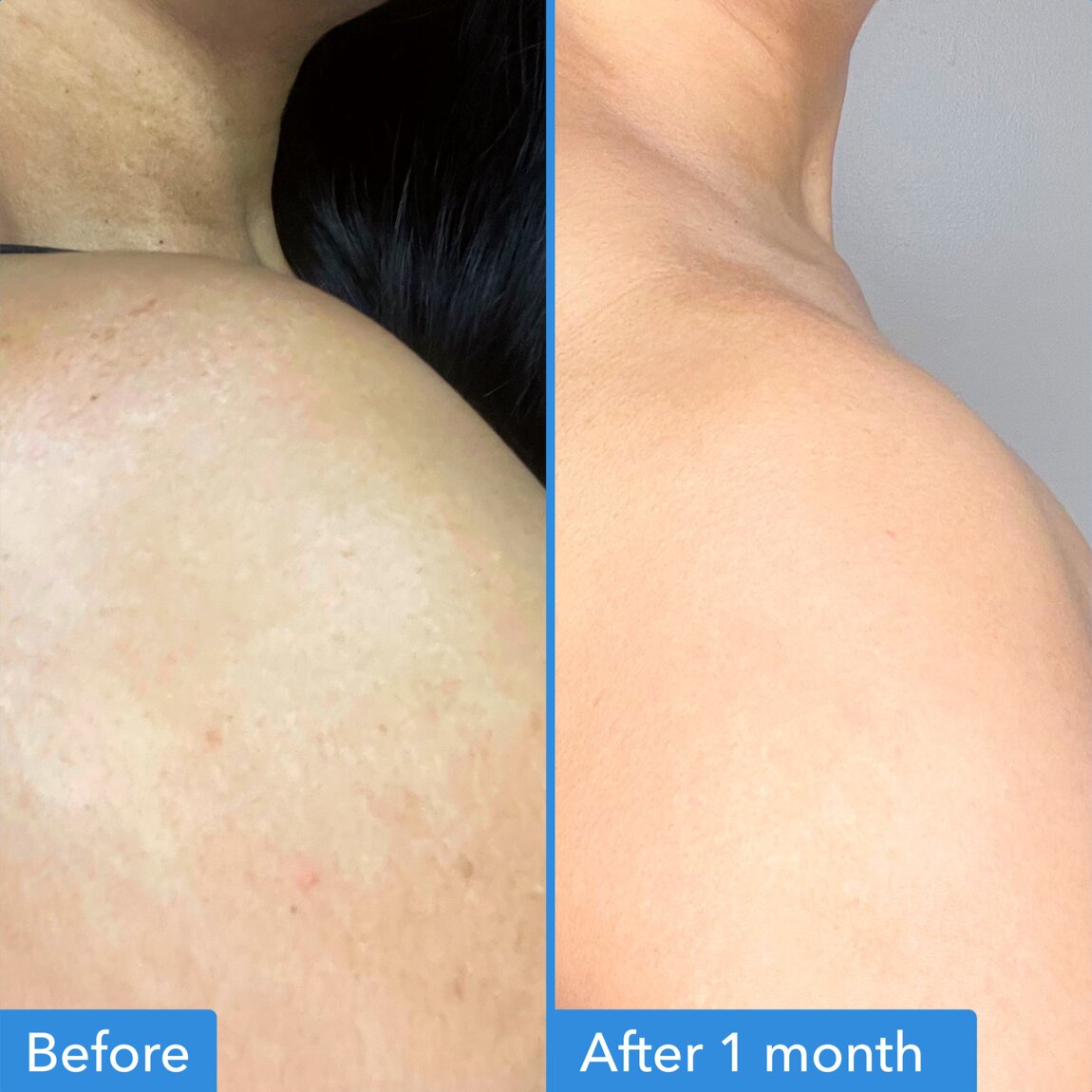 discoloration-correcting-body-treatment-y9 zb_p.jpg