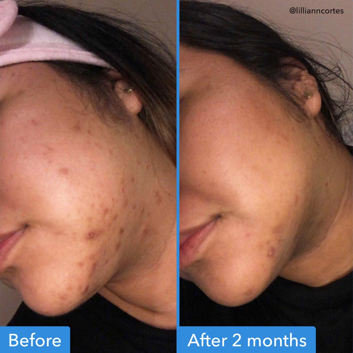 discoloration-correcting-serum-o2 zb_p.jpg